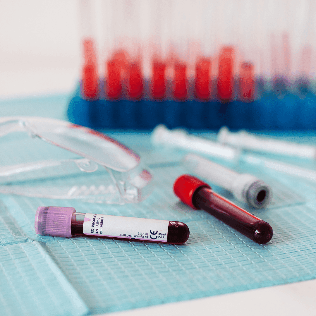 Provette con campioni di sangue appoggiate su un piano sanitario, con dispositivi medici sullo sfondo.