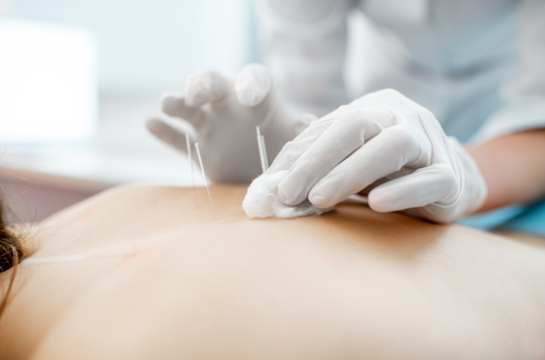 L'Agopuntura approda all’Ospedale di Tradate: tra Tradizione Orientale e Innovazione Clinica
